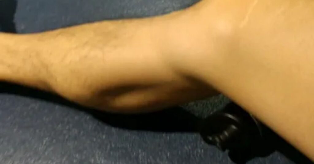 Why Leg Muscles Lock Like Stone at Night: Causes of Severe Calf Spasms